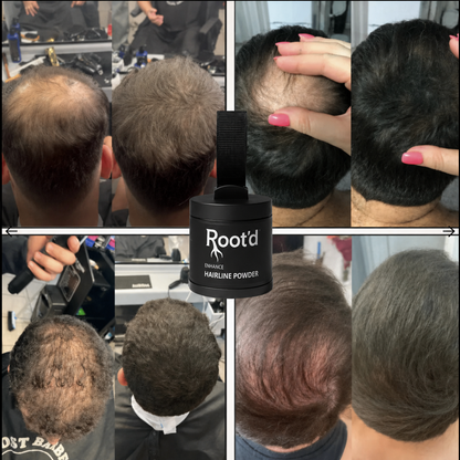 Hair Density Fillers - Instant Coverage. Zero Transfer. 24-Hour Hold.