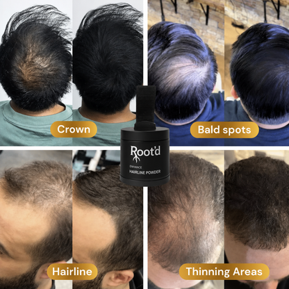 Hair Density Fillers - Instant Coverage. Zero Transfer. 24-Hour Hold.