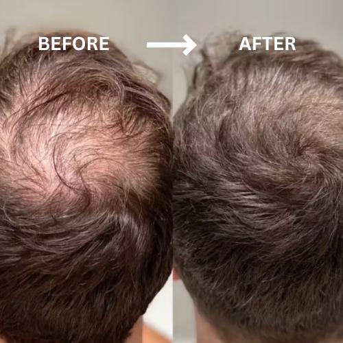 Hair Density Refill Pod