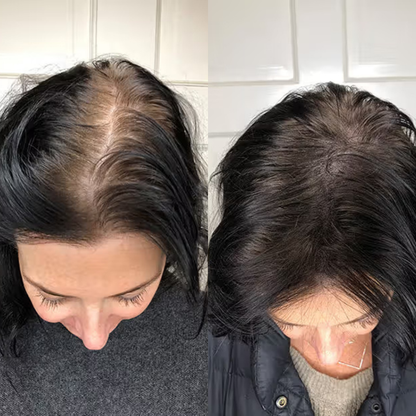 Hair Density Refill Pod