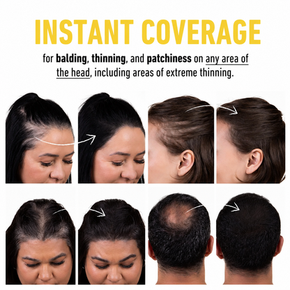 Hair Density Fillers – Instant Coverage. Zero Transfer. 24-Hour Hold